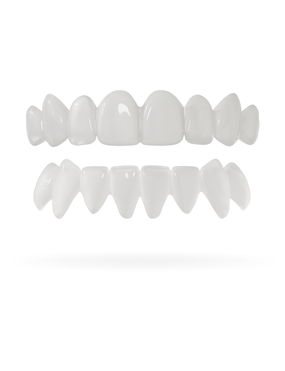 Tand-Veneer 3.0